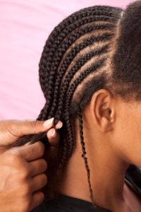 Tight Hair Styles like Cornrows can lead to traction alopecia & permanent hair loss